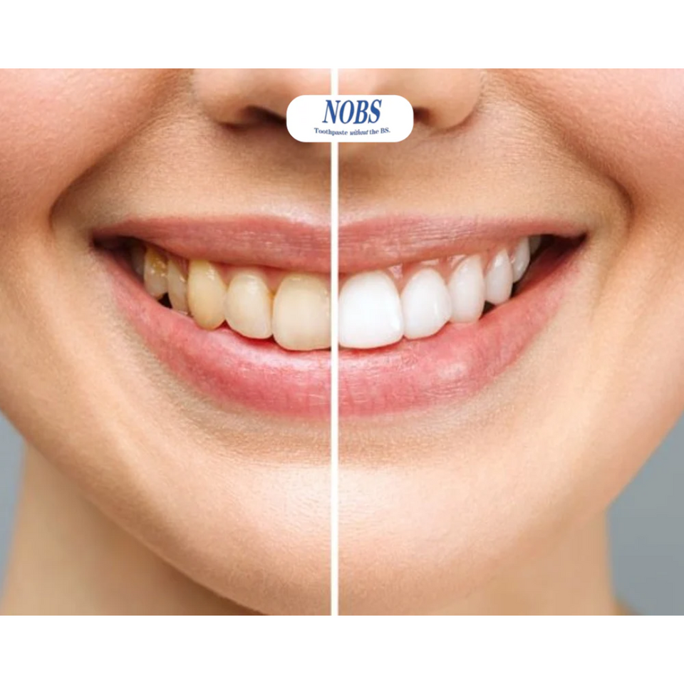 TABLETAS DE PASTA DENTAL-NOBS ✅